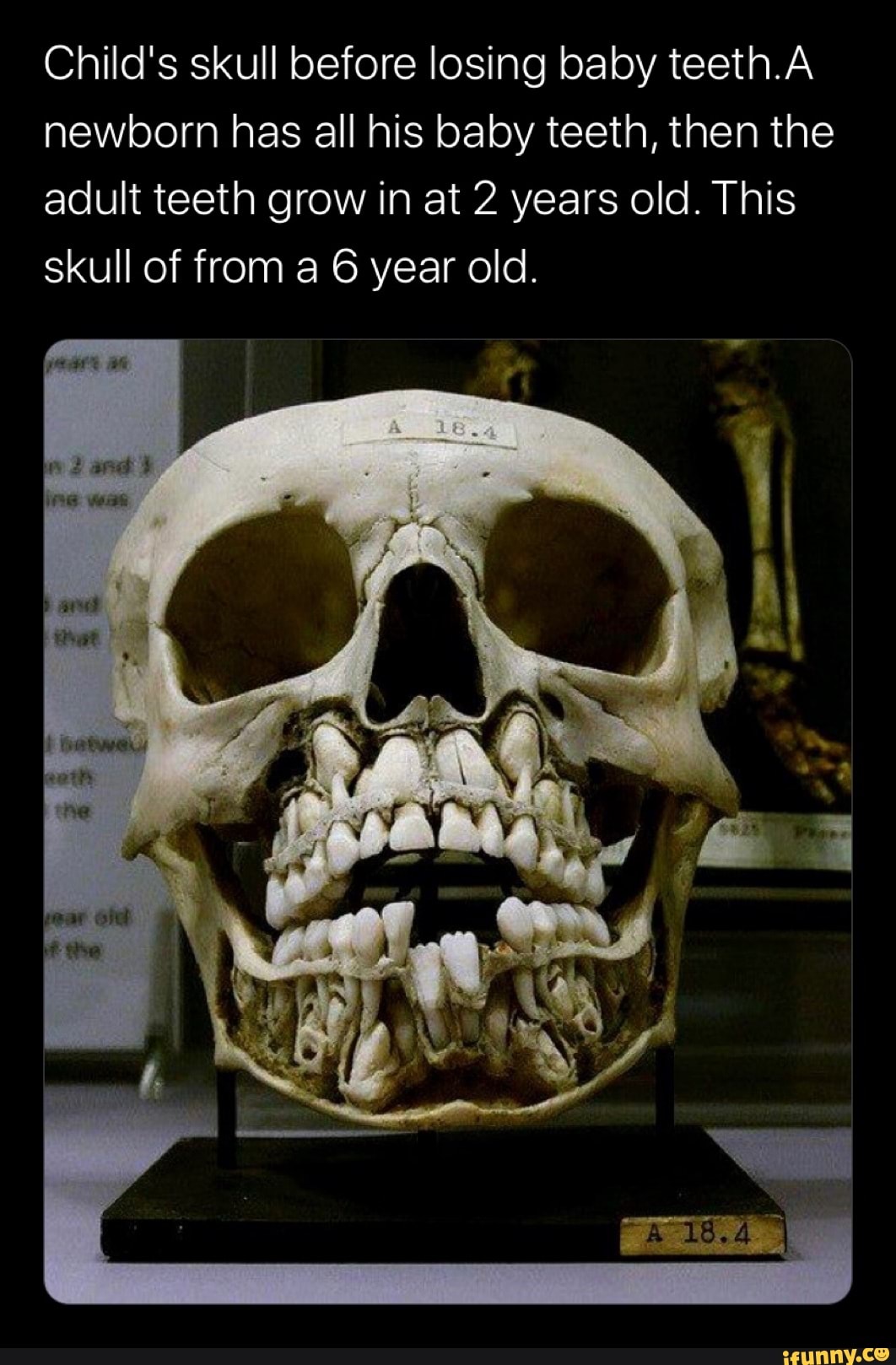 Рентген черепа ребенка зубы