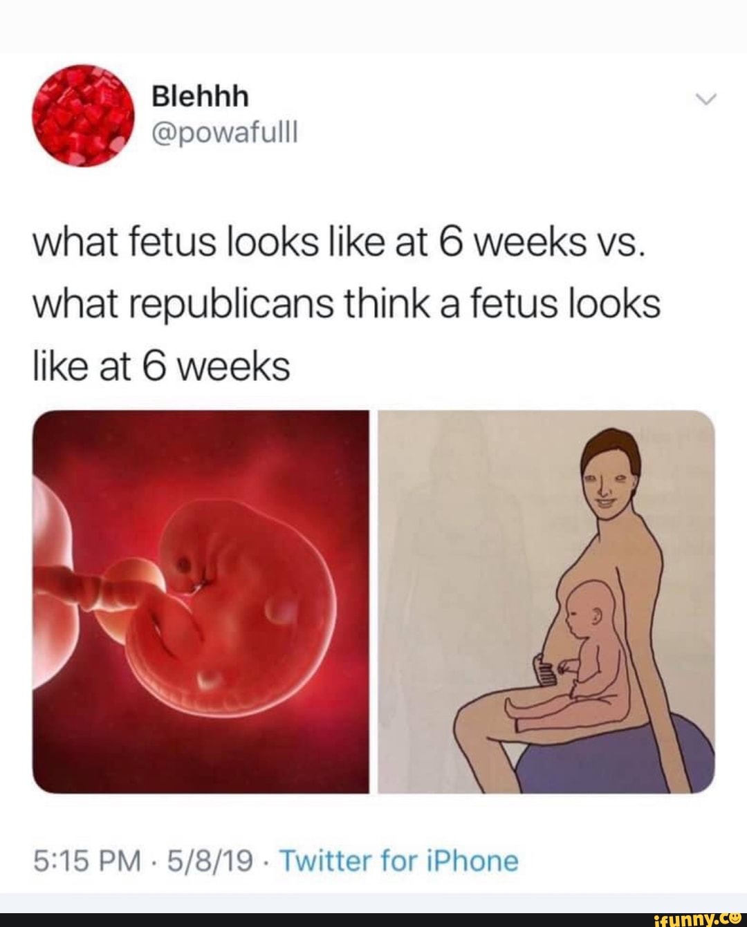 what-fetus-looks-like-at-6-weeks-vs-what-republicans-think-a-fetus