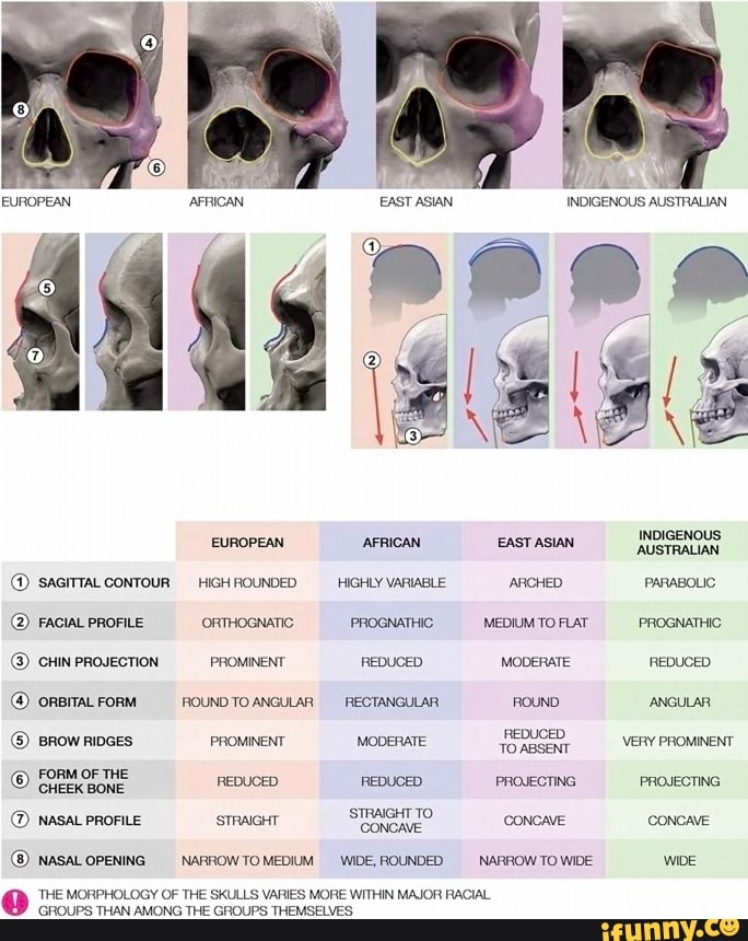 EUROPEAN SAGITTAL CONTOUR HIGH ROUNDED FACIAL PROFILE ORTHOGNATIC