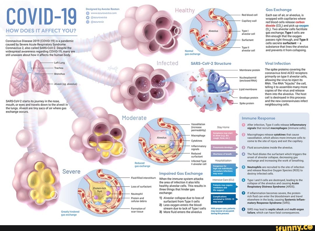 cre 3) More fluid enter the alveolus
(O Macrophages release cytokines that couse
[rear om
ERP
Creat hindered
gererchange