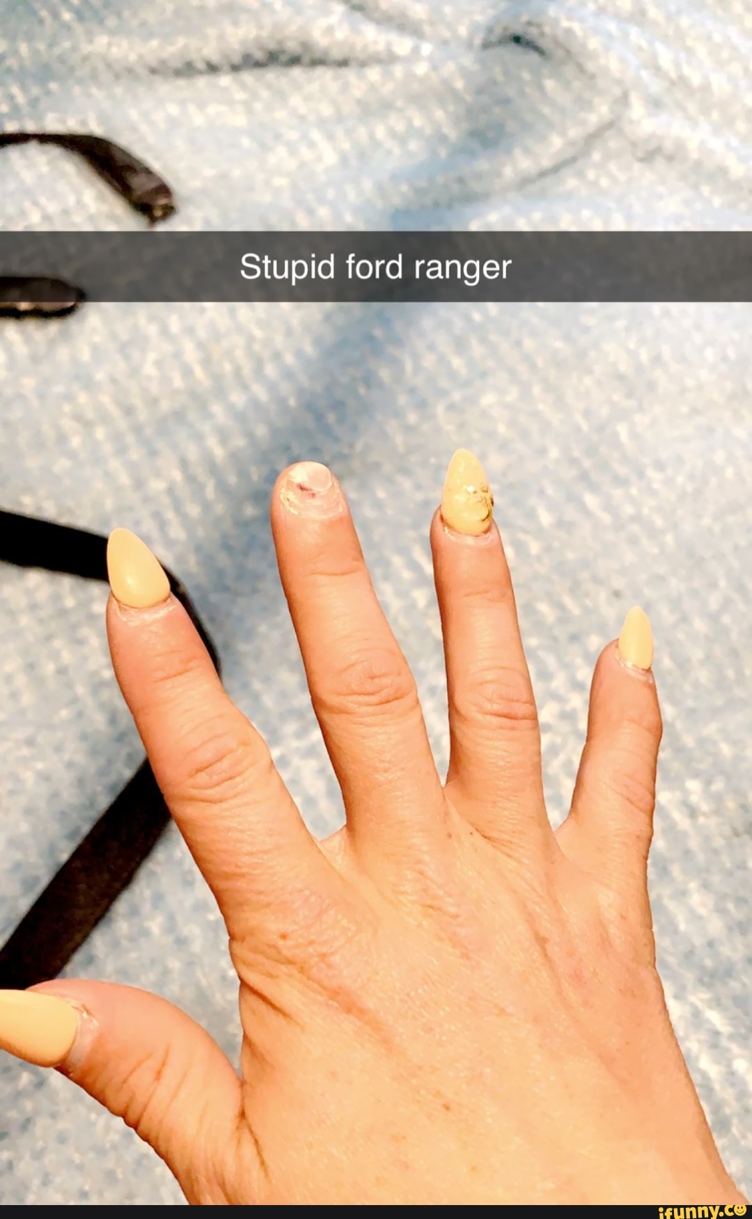 bruh broken nails HHURT  rboysarequirky