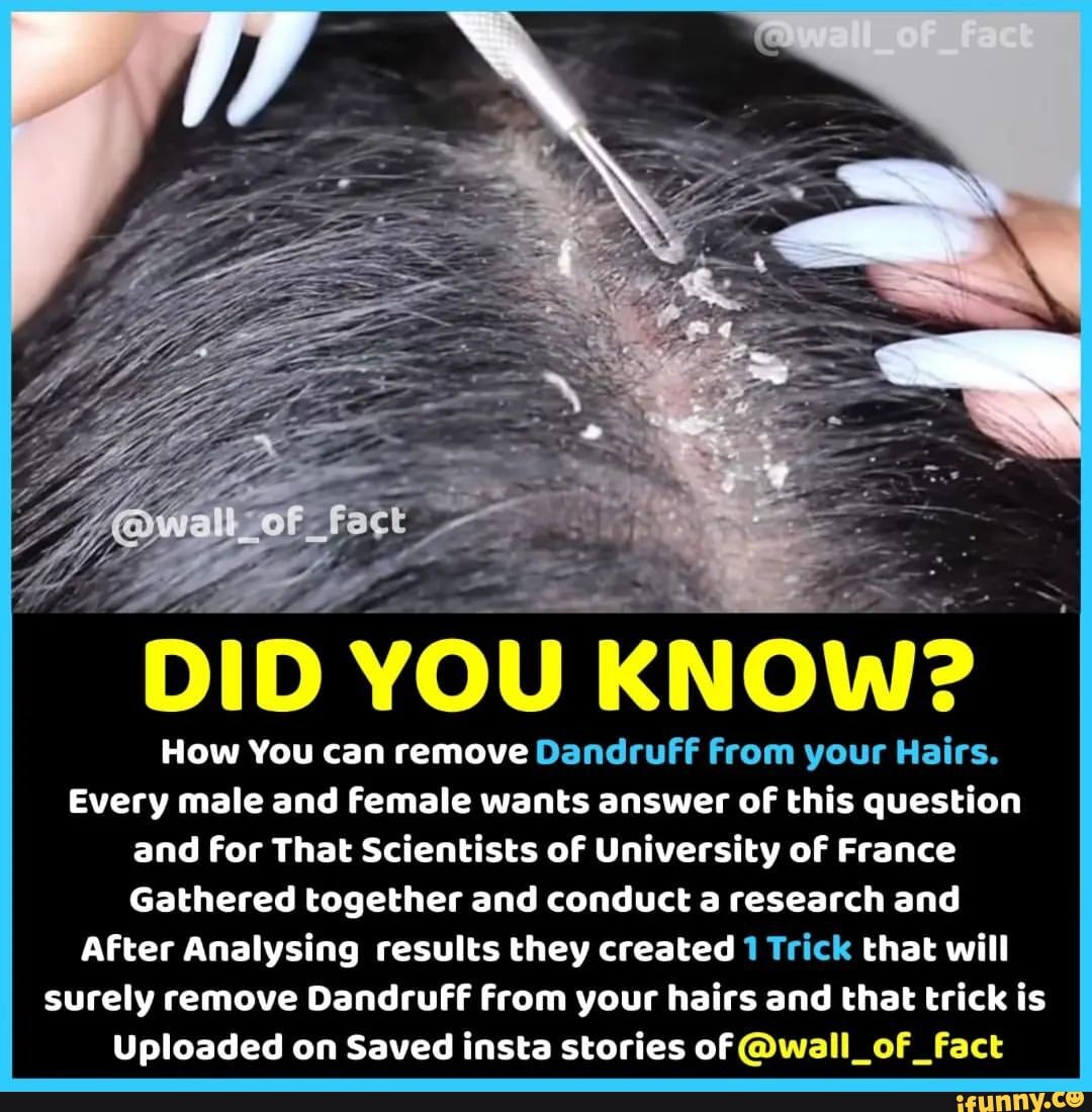 DID YOU KNOW? How You can remove Dandruff From your Hairs. Every male ...