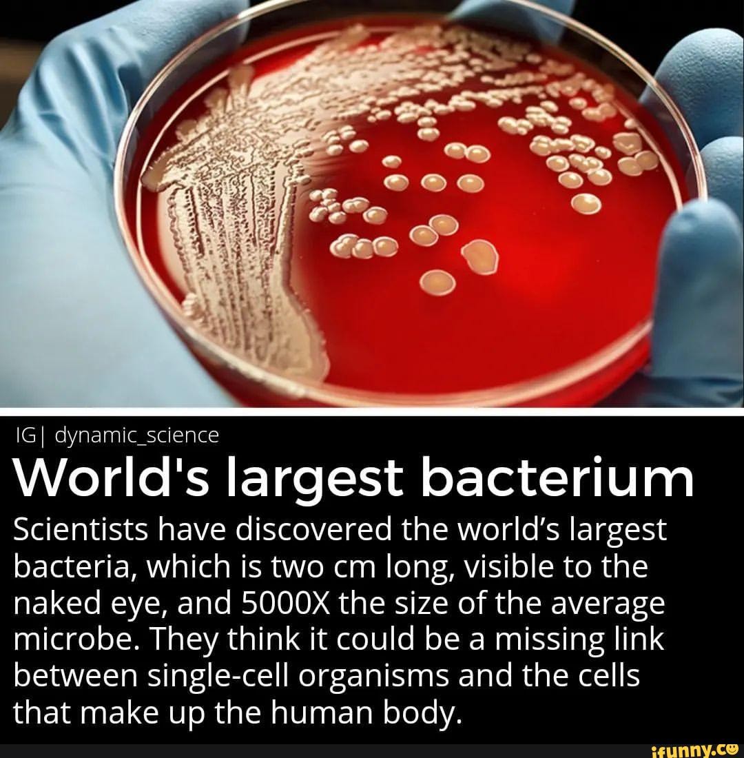 IGI Dynamic Science World S Largest Bacterium Scientists Have Discovered The World S Largest