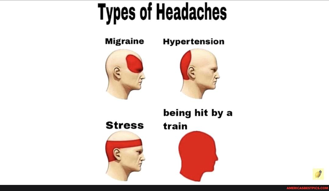Types of Headaches being hit by a.