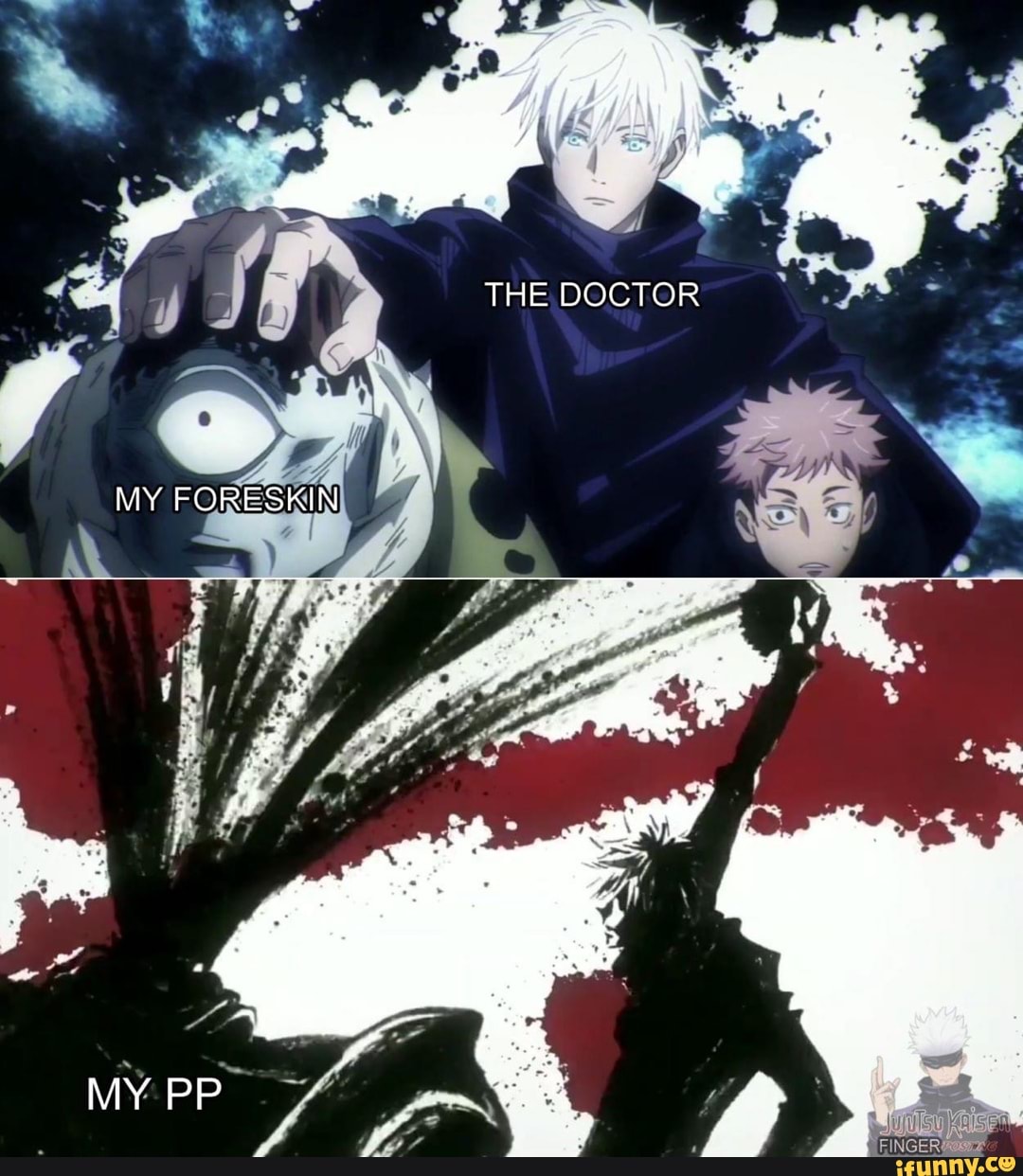 THE DOCTOR
MY FORESKIN