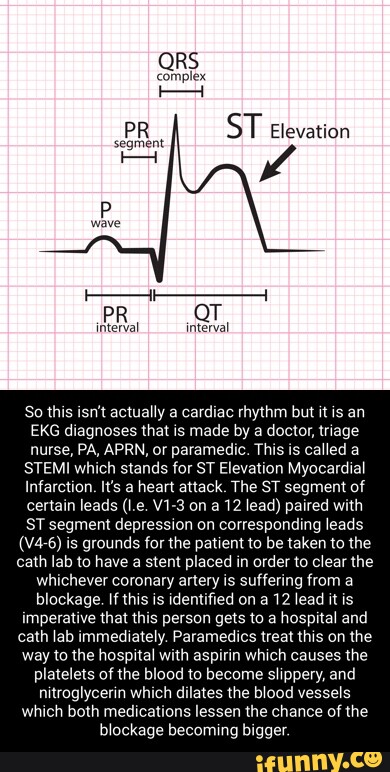 Ekg memes. Best Collection of funny Ekg pictures on iFunny