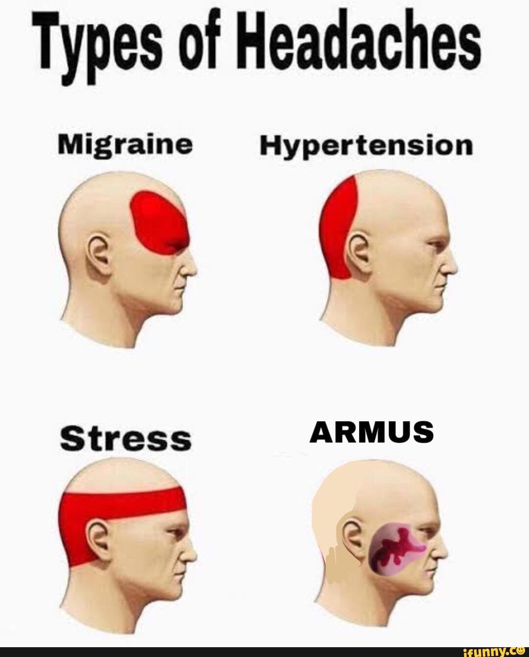 Types of Headaches Migraine Hypertension Stress ARMUS - iFunny