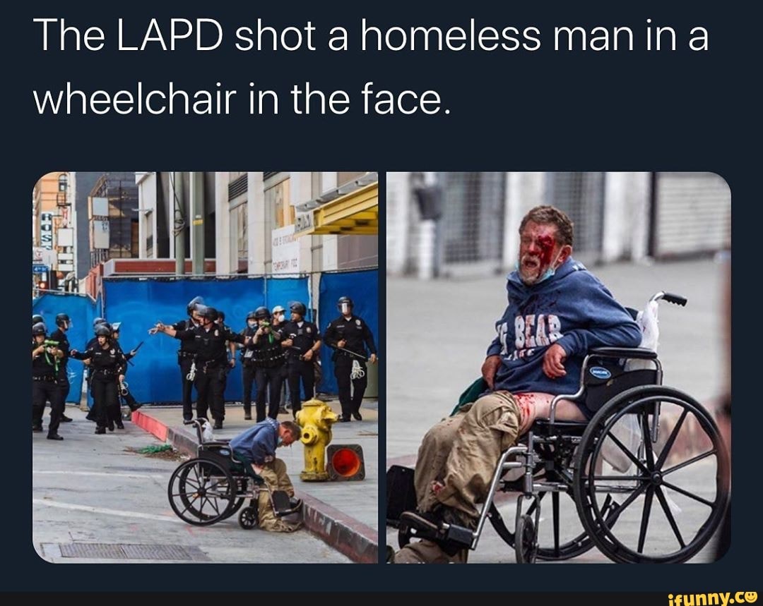 The LAPD shot a homeless man ina
wheelchair in the face.