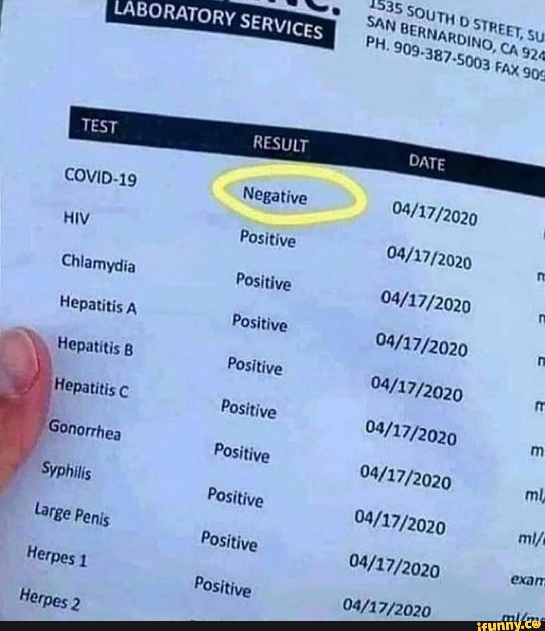 4335 SOUTH STREET,
SAN BERNARDING, CA 924
ABORATORY PH. 909-387.5093 FA)
COVID-19 Negative
HIV Positive n
Chlamydia Positive
Hepatitis g Positive
Hepatitis c PoSitive
Sonorrhea Positive
Syphilis Positive mi/
Large Positive exan
Herpes
