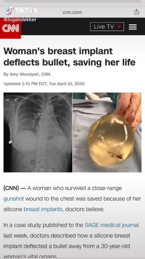 TikTok @ogandekker cnn com Woman's breast implant deflects ...