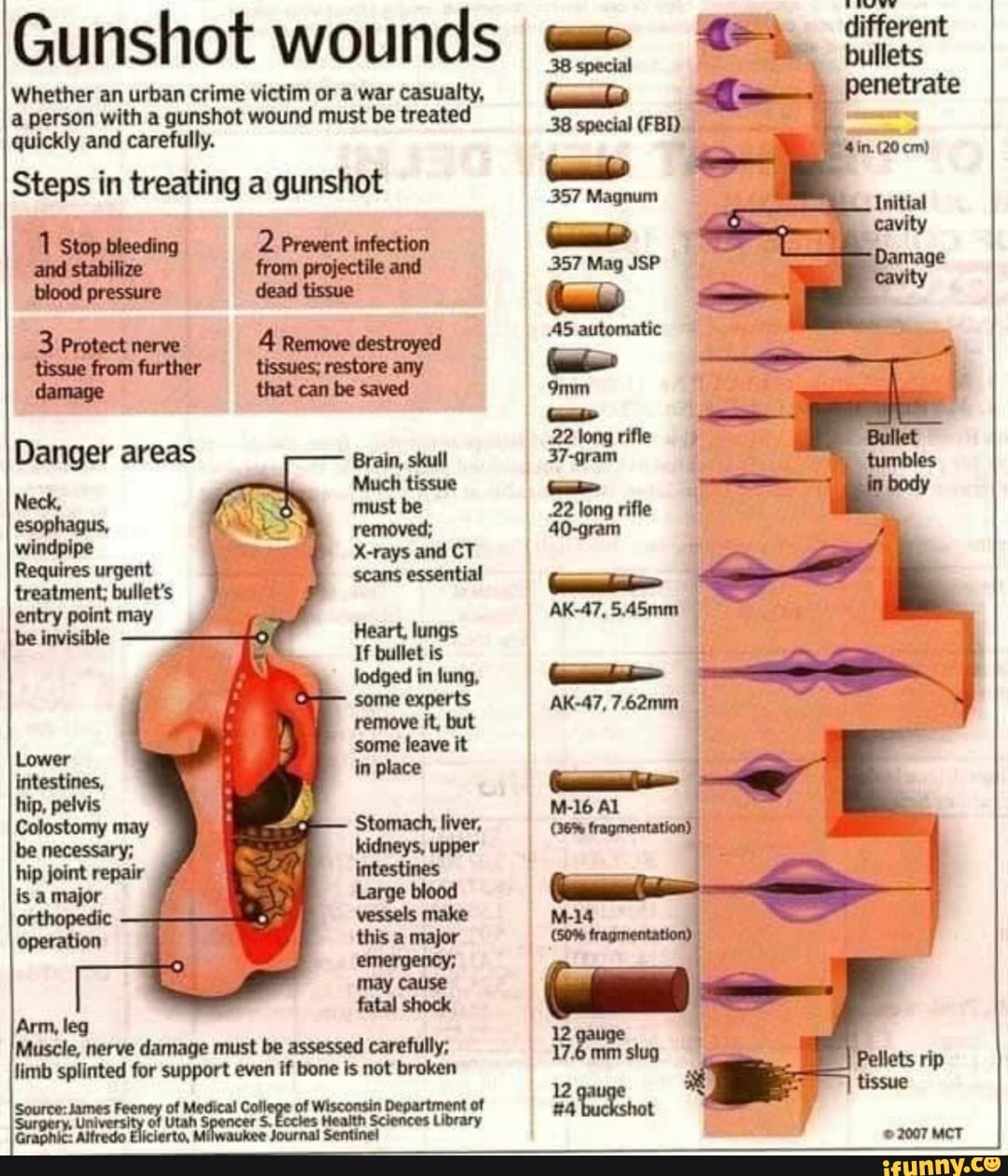 gunshot-wounds-oo-whether-an-urban-crime-victim-or-a-war-casualty