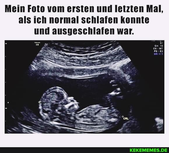 Mein Foto vom ersten und letzten Mal, als ich normal schlafen konnte und ausgeschlafen war.