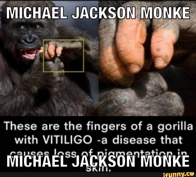 MICHAEL JACKSON MONKE These are the fingers of a gorilla with VITILIGO