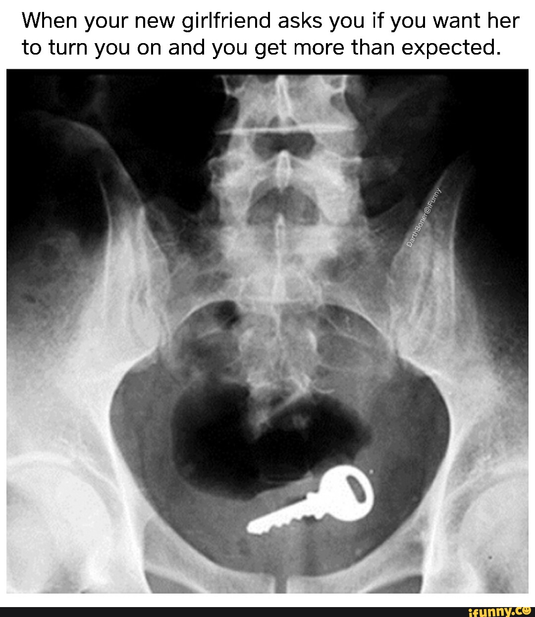 Xray memes. Best Collection of funny Xray pictures on iFunny Xray memes. Best Collection of funny Xray pictures on iFunny