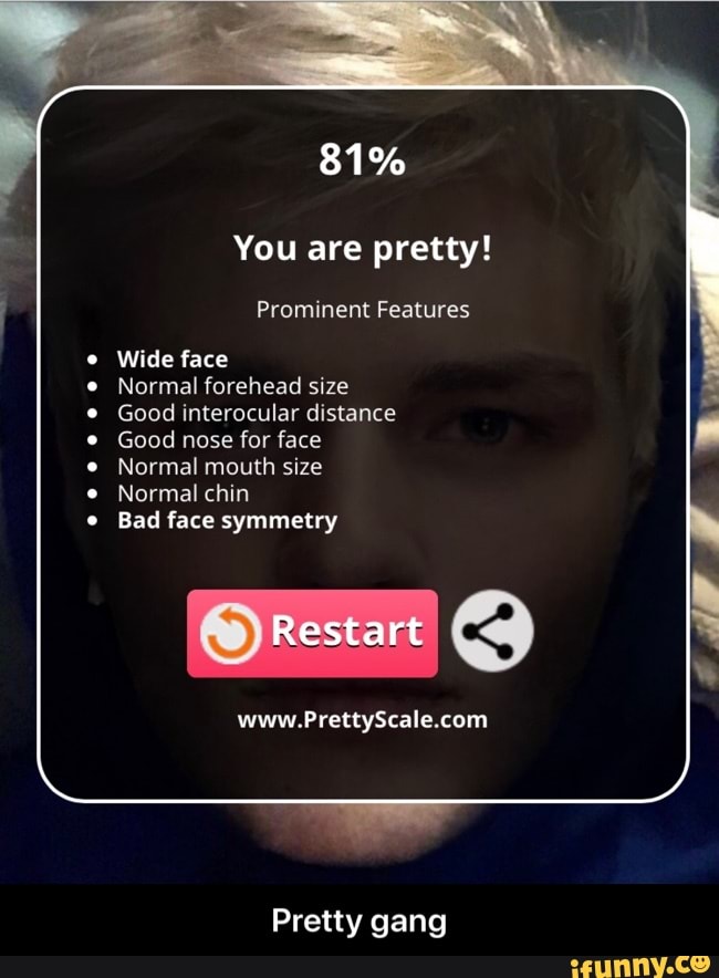You are pretty!
Prominent Features
Wide face
Normal forehead size
Good interocular distance
Good nose for face
Normal mouth size
Bad face symmetry
9
Pretty gang - Pretty gang