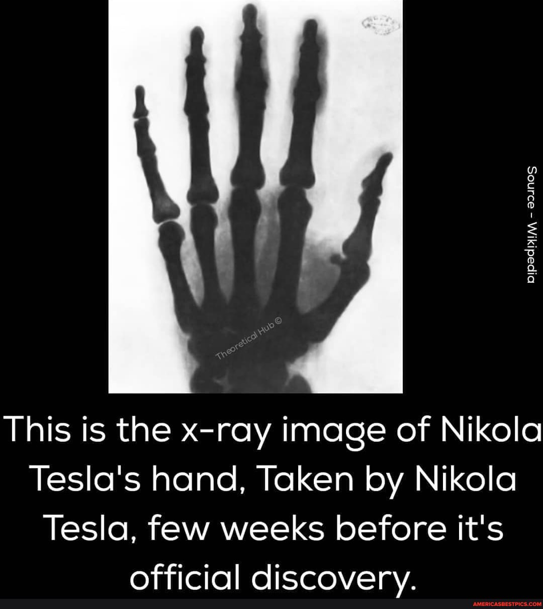 Laved
This is the x-ray image of Nikola
Tesla's hand, Taken by Nikola
Tesla, few weeks before it's official discoverv.