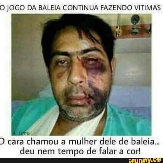 O JOGO DA BALEIA CONTINUA FAZENDO VITIMAS
D cara
chamou a
mulher dele de baleia...
deu nem tempo de falar a cor!