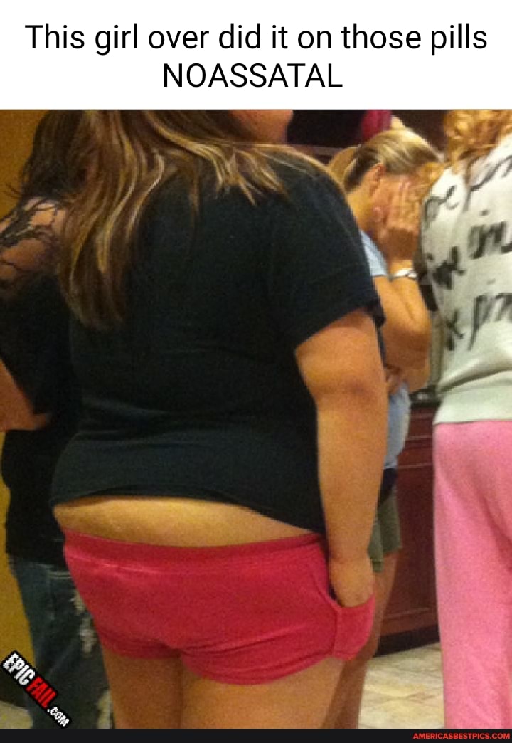 This girl over did it on those pills
NOASSATAL