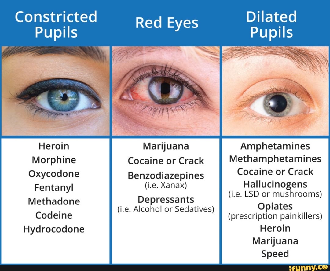 constricted-dilated-red-eyes-pupils-red-eyes-pupils-ss-i-heroin