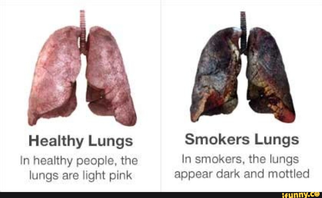 Healthy Lungs Smokers Lungs In healthy people, the In smokers, the ...