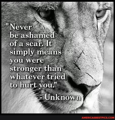 "Nower be axhamed ofa xcar, simply. means you were stronecr than whatever tried to hurt vou."
Unknown