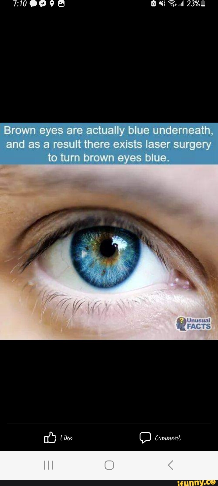 Laser procedure can turn brown eyes blue