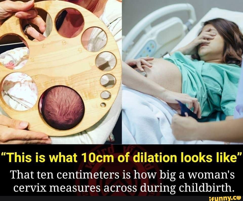 this-is-what-10cm-of-dilation-looks-like-that-ten-centimeters-is-how