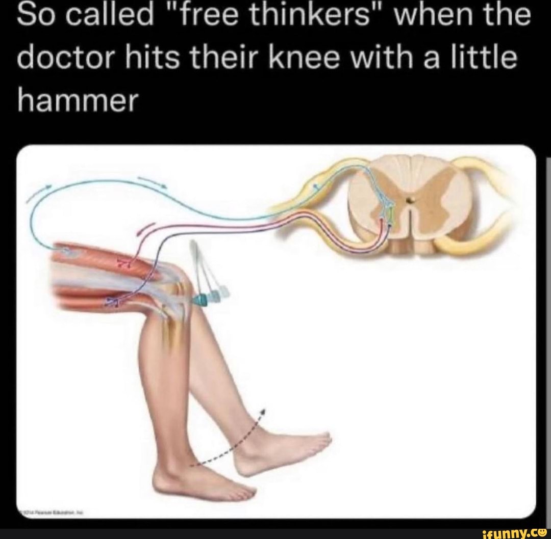 So called "free thinkers" when the doctor hits their knee with a little