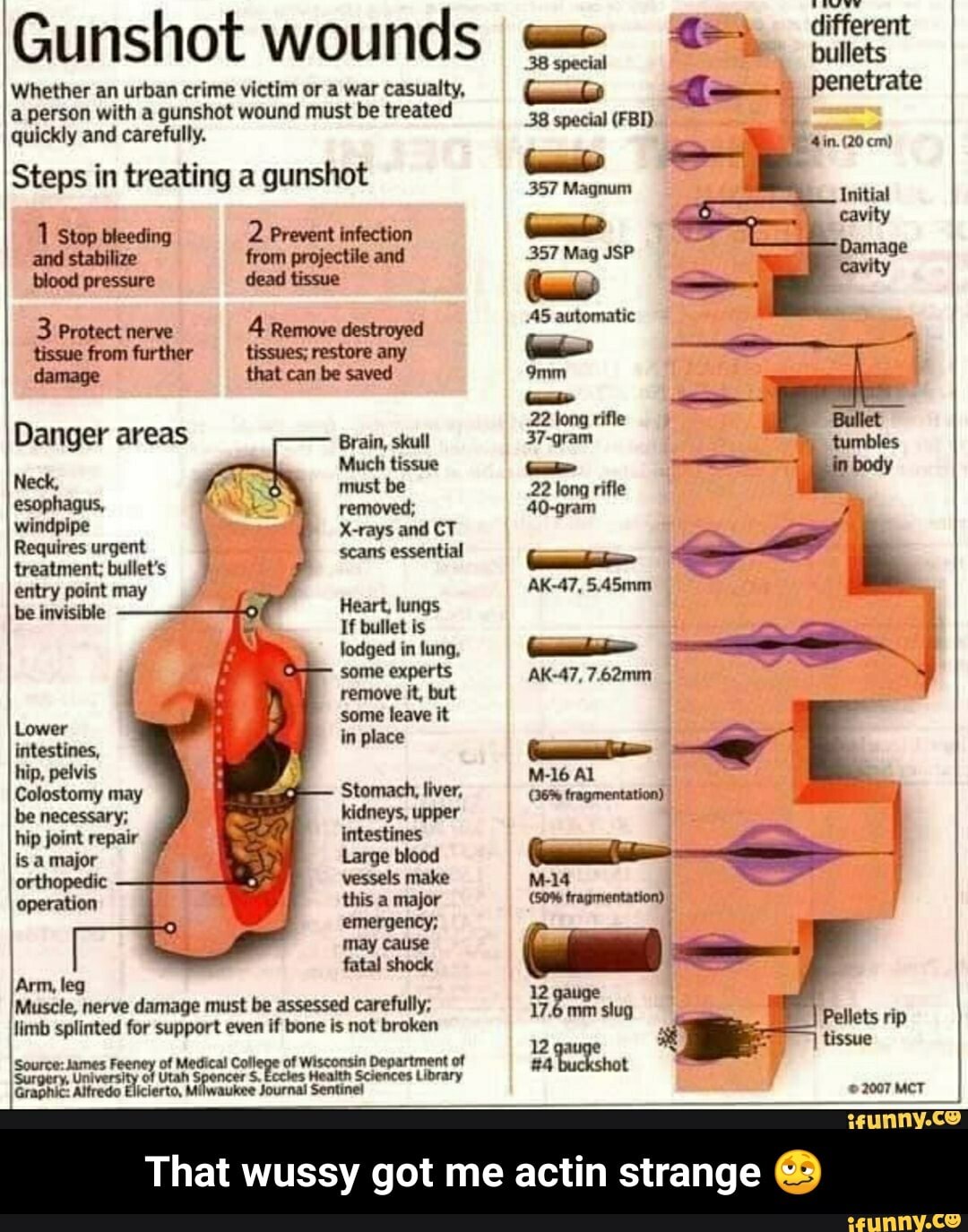 Gunshot Wounds Whether An Urban Crime Victim Or A War Casualty, A ...