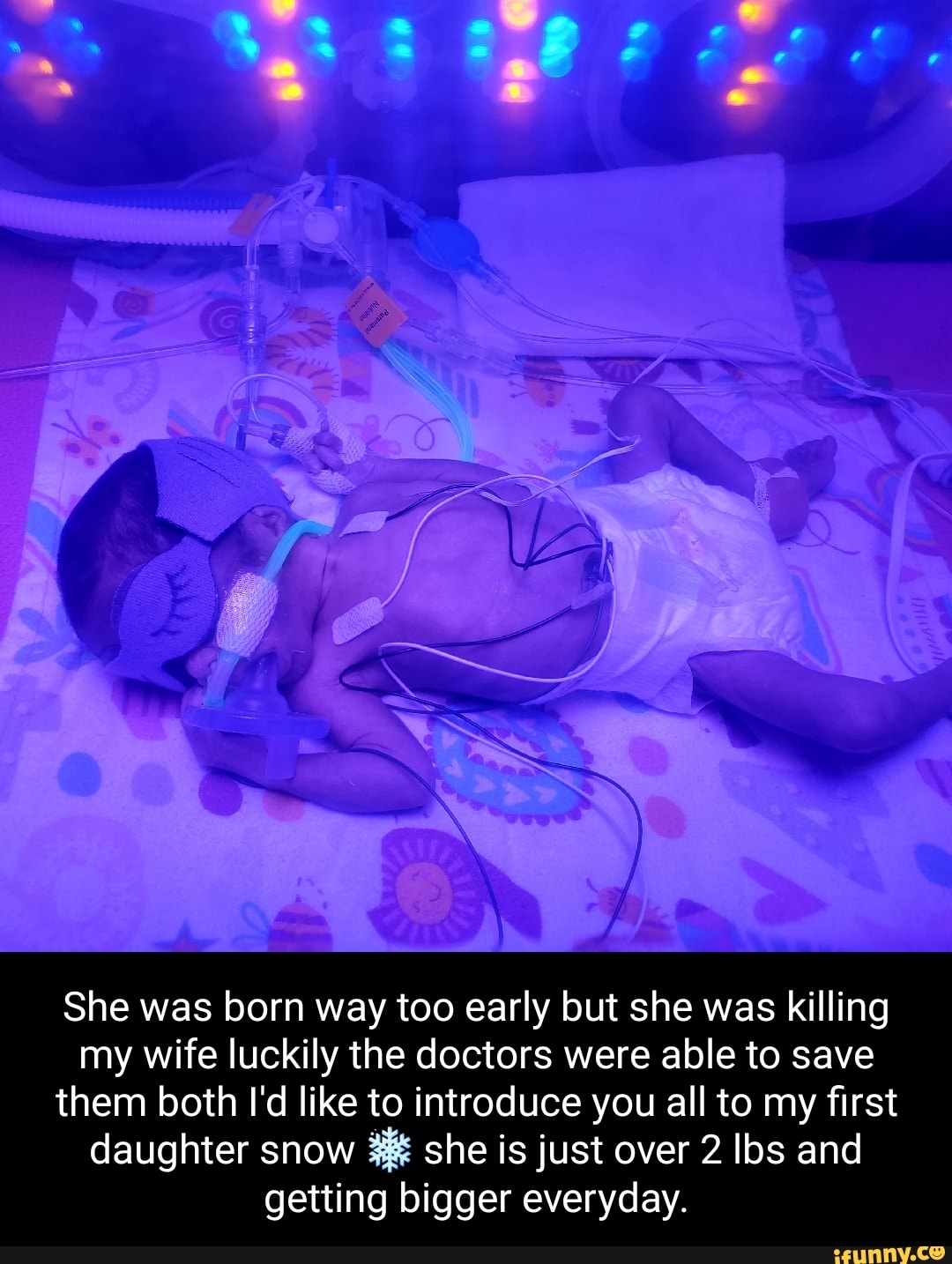 She was born way too early but she was killing my wife luckily the doctors were able to save them both I'd like to introduce you all to my first daughter snow she is just over 2 lbs and getting bigger everyday.