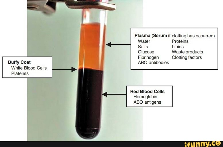 Components of blood - Buffy Coat White Blood Cells Platelets Plasma ...