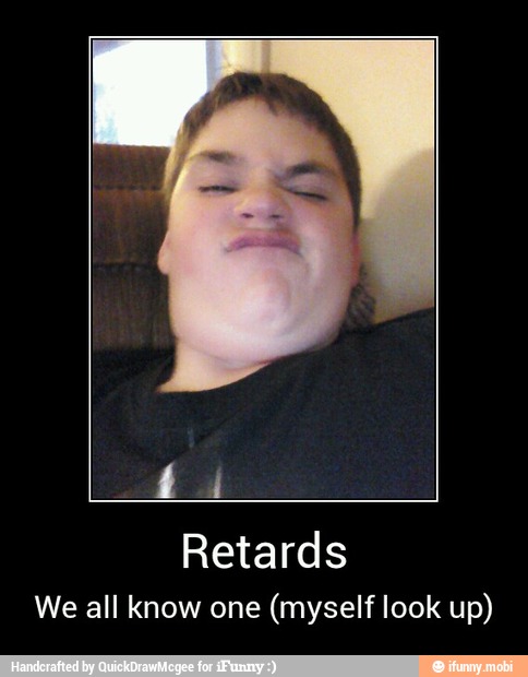 Retards
We all know one
(myself look up) - Retards
We all know one (myself look up)