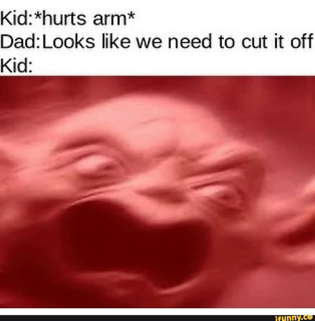 arm-like-we-need-to-cut-it-off-kid