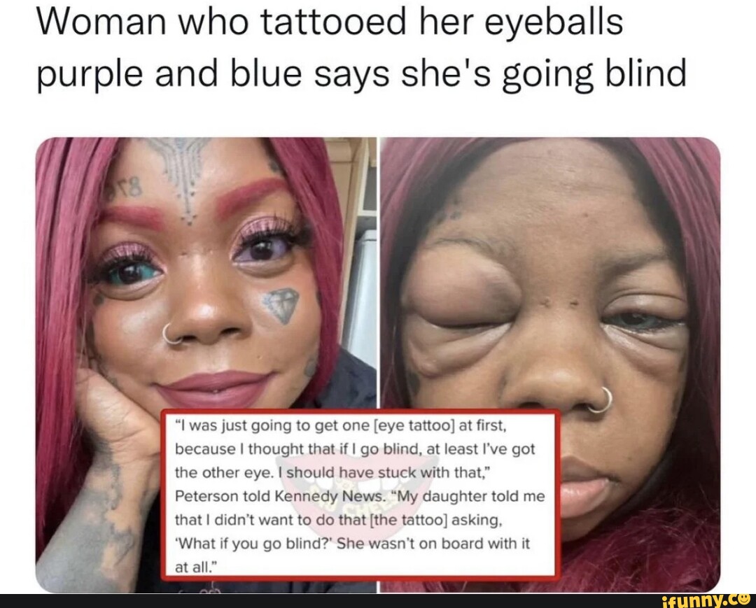 Woman Who Tattooed Her Eyeballs Purple And Blue Says She S Going Blind   Ab2b4e7292738185bd2ccf6e3c3f62ee3a1fd2f9e3f3de3d09ef0e829a3b7867 1 