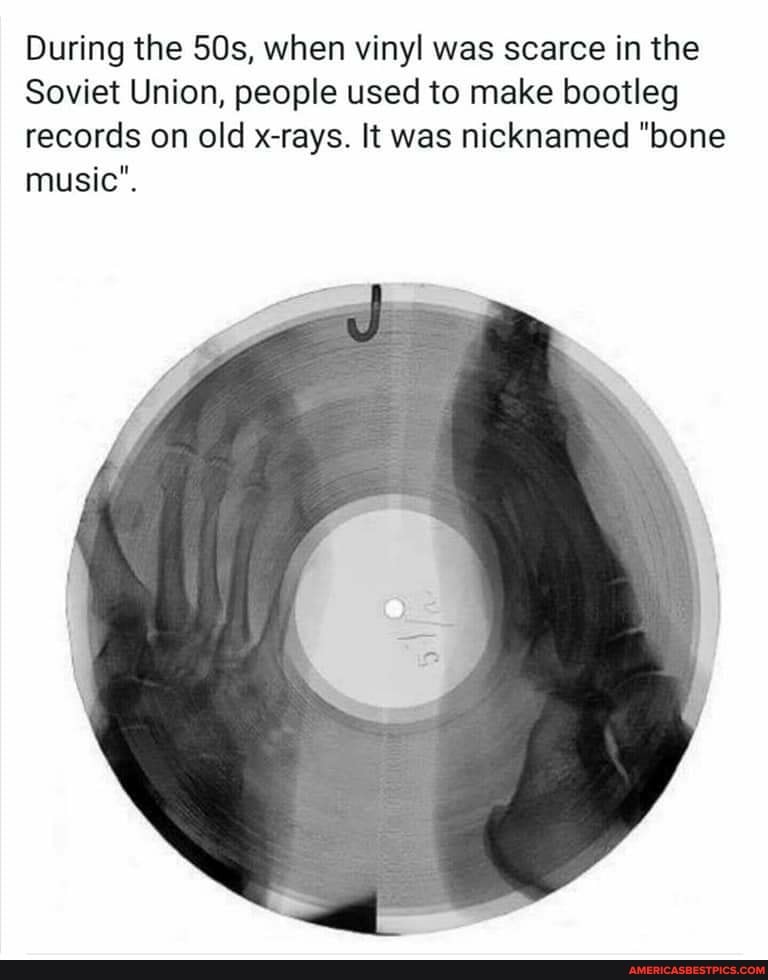 During the when vinyl was scarce in the
Soviet Union, people used to make bootleg records on old x-rays. It was nicknamed "bone music".