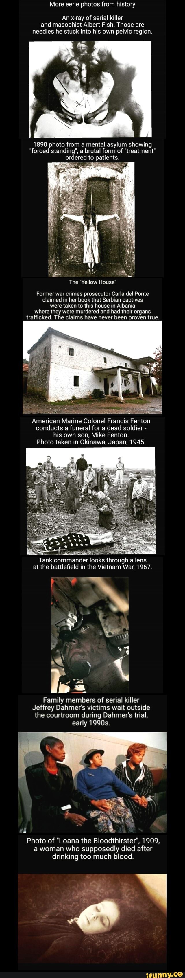 More eerie photos from history An xray of serial killer and masochist