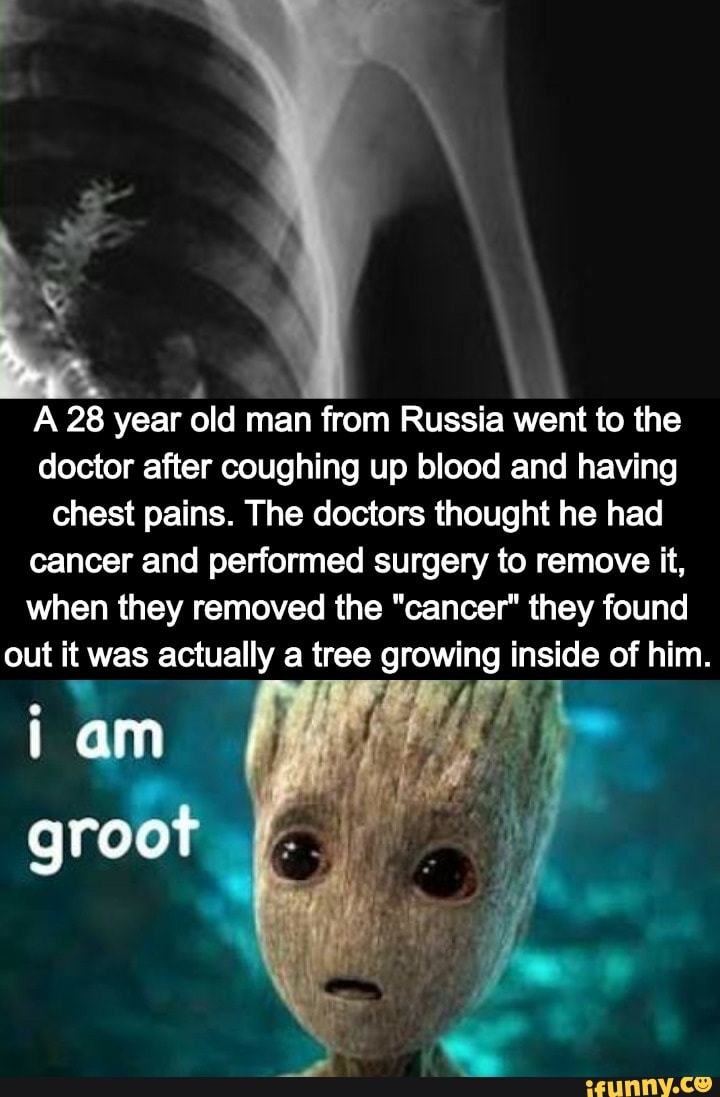 VA
A 28 year
old
man from Russia went to the
doctor after coughing up blood and having
chest pains. The doctors thought he had
cancer and performed surgery to remove it,
when they removed the "cancer" they found
out it was actually a tree growing inside of him.