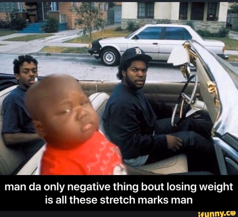 man da only negative thing bout losing weight
is all these stretch marks man - man da only negative thing bout losing weight is all these stretch marks man