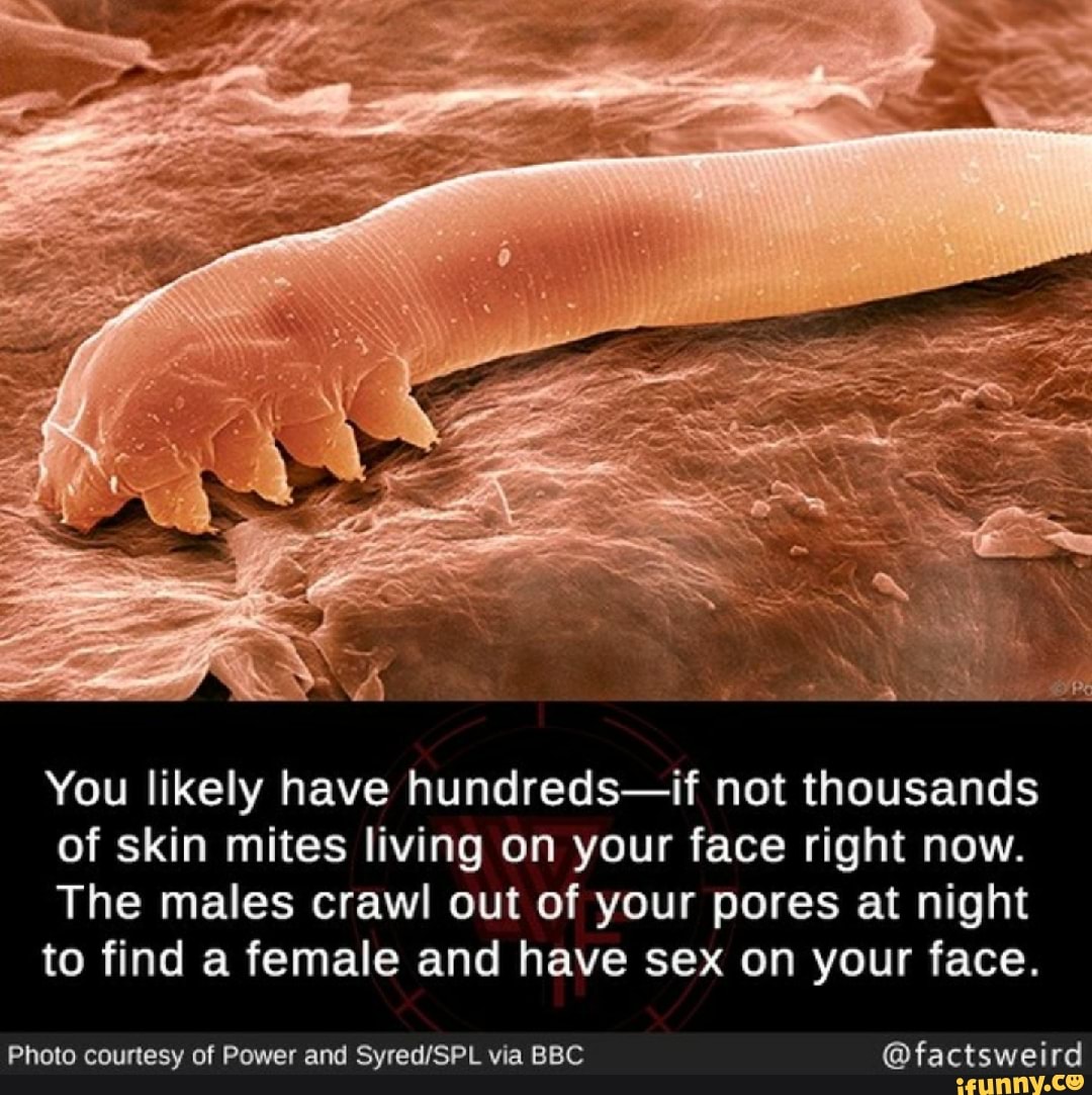 You Likely Have Hundreds If Not Thousands Of Skin Mites Living On Your Face Right Now The Males 5927