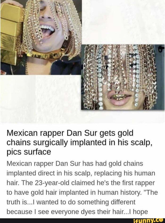 23year old Mexican rapper DanSur surgically implants gold chains into  his head to serve as his hair He claims hes the first rapper in human  history to rock an assortment of gold