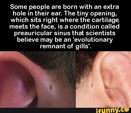 people born with gills