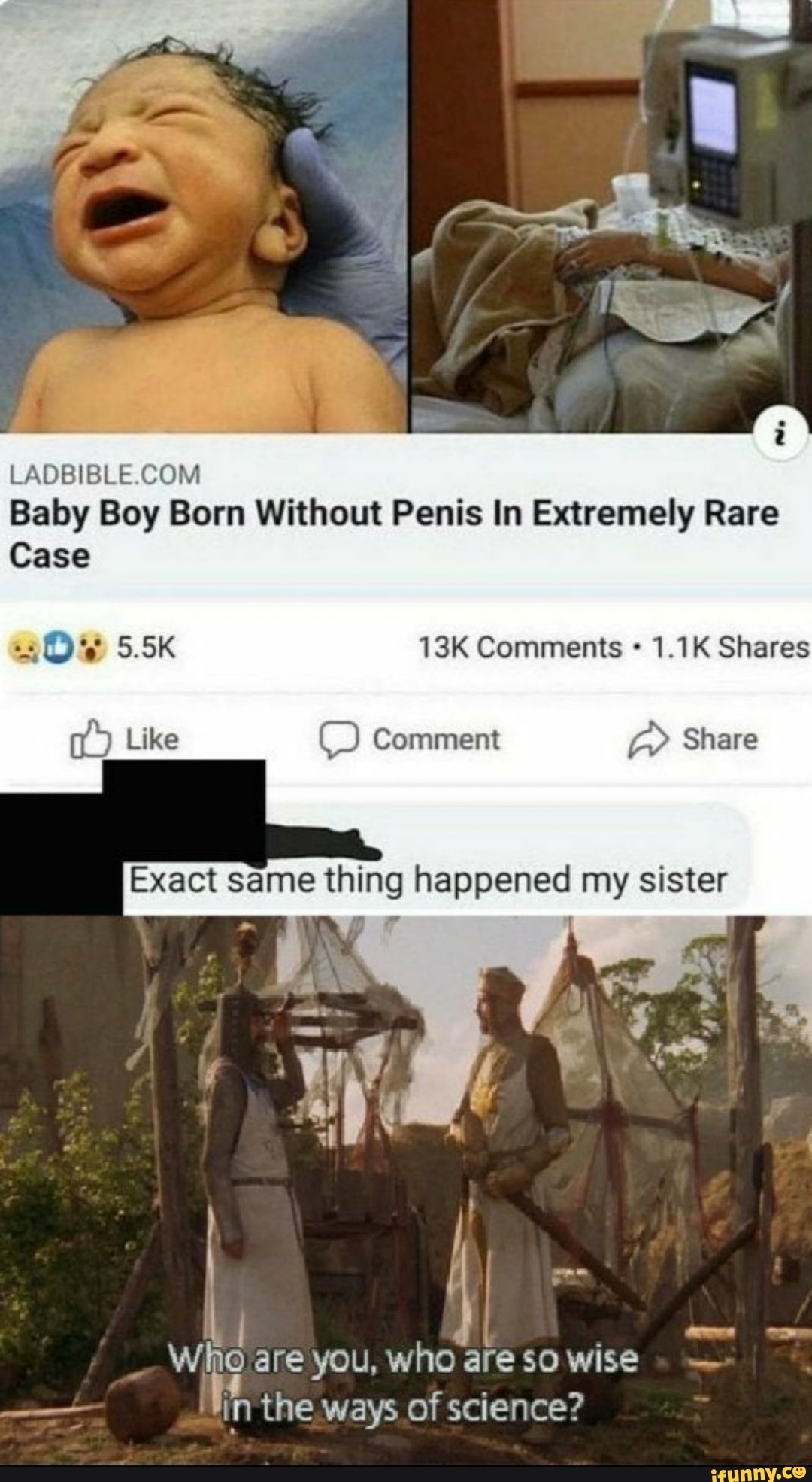 Baby Boy Born Without Penis In Extremely Rare Case 1.1K Shares Exact