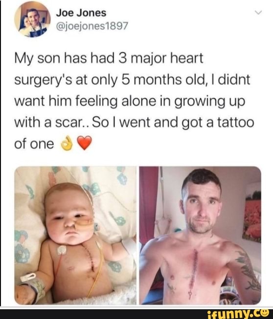 My son has had 3 major heart
surgery's at only 5 months old, I didnt
want him feeling alone in growing up
with a scar.. So I went and got a tattoo
ofone Y Y