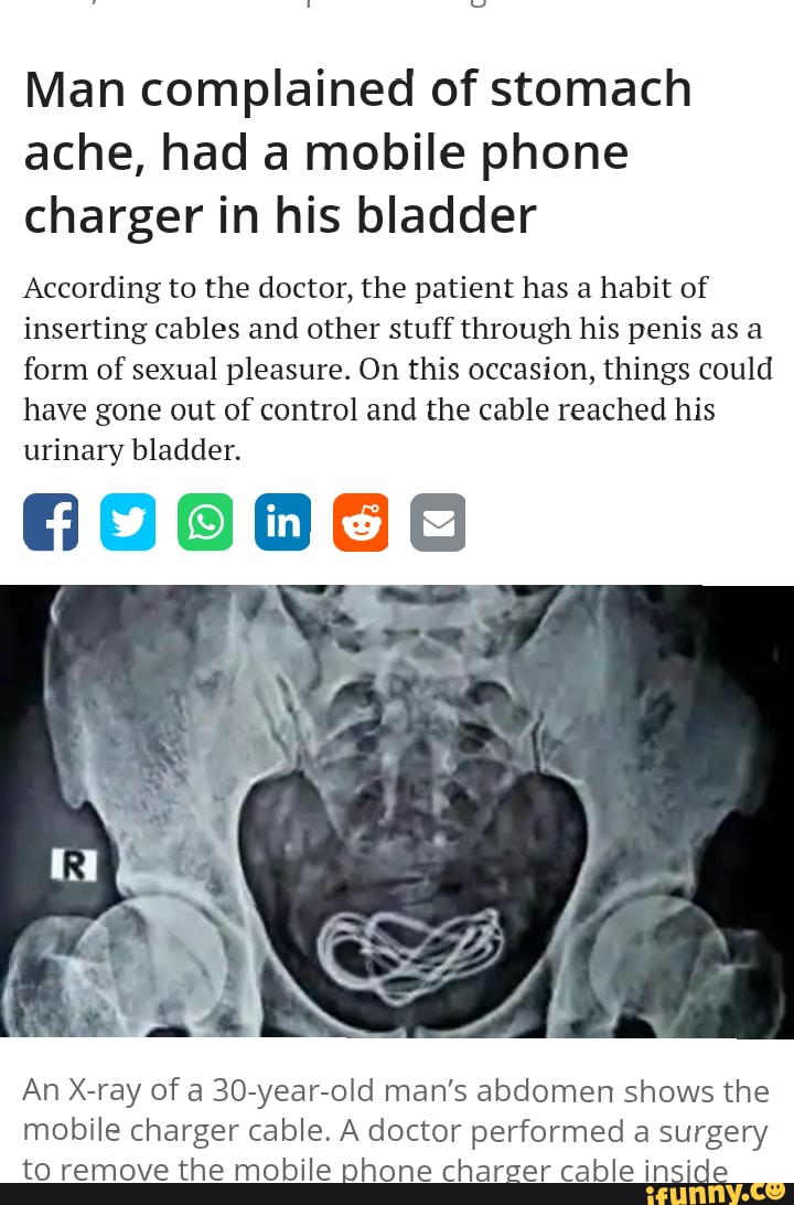 Man complained of stomach ache, had a mobile phone charger in his bladder
According to the doctor, the patient has a habit of inserting cables and other stuff through his penis as a form of sexual pleasure. On this occasion, things could have gone out of control and the cable reached his urinary bladder.
An X-ray of a 30-year-old man's abdomen shows the mobile charger cable. A doctor performed a surgery