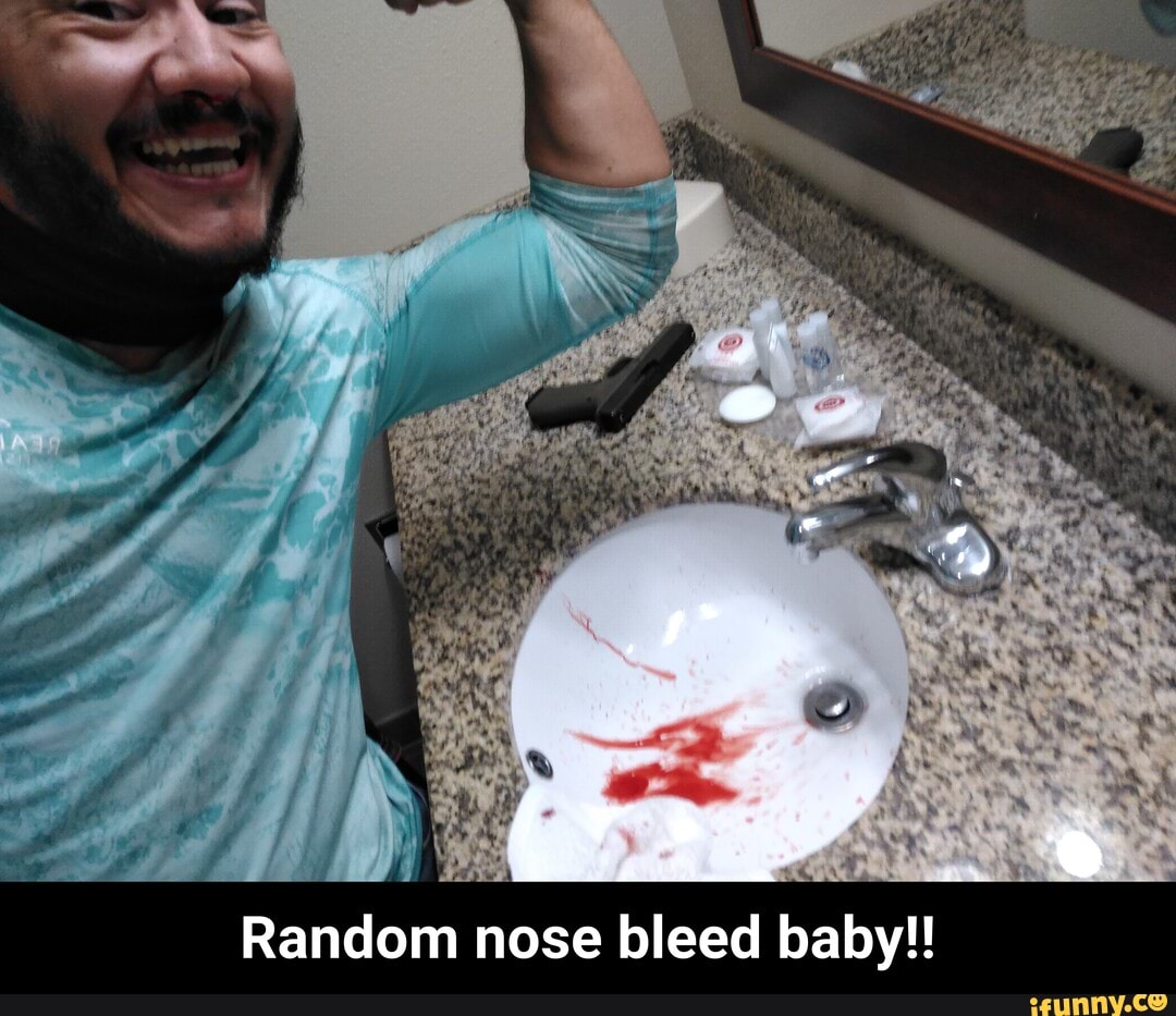 random nose bleed