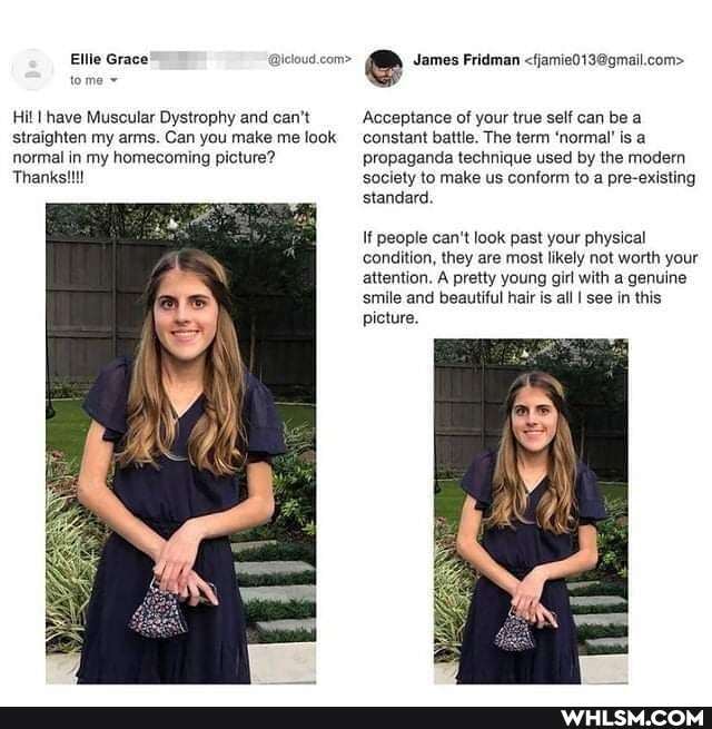 Ellie Grace @icloud.com> e James Fridman
Hil I have Muscular Dystrophy and can't straighten my arms. Can you make me look normal in my homecoming picture?
Thanks
Acceptance of your true self can be a constant battle. The term 'normal' is a propaganda technique used by the modern society to make us conform to a pre-existing standard.
If people can't look past your physical condition, they are most likely not worth your attention. A pretty young girl with a genuine smile and beautiful hair is all I see in this picture.