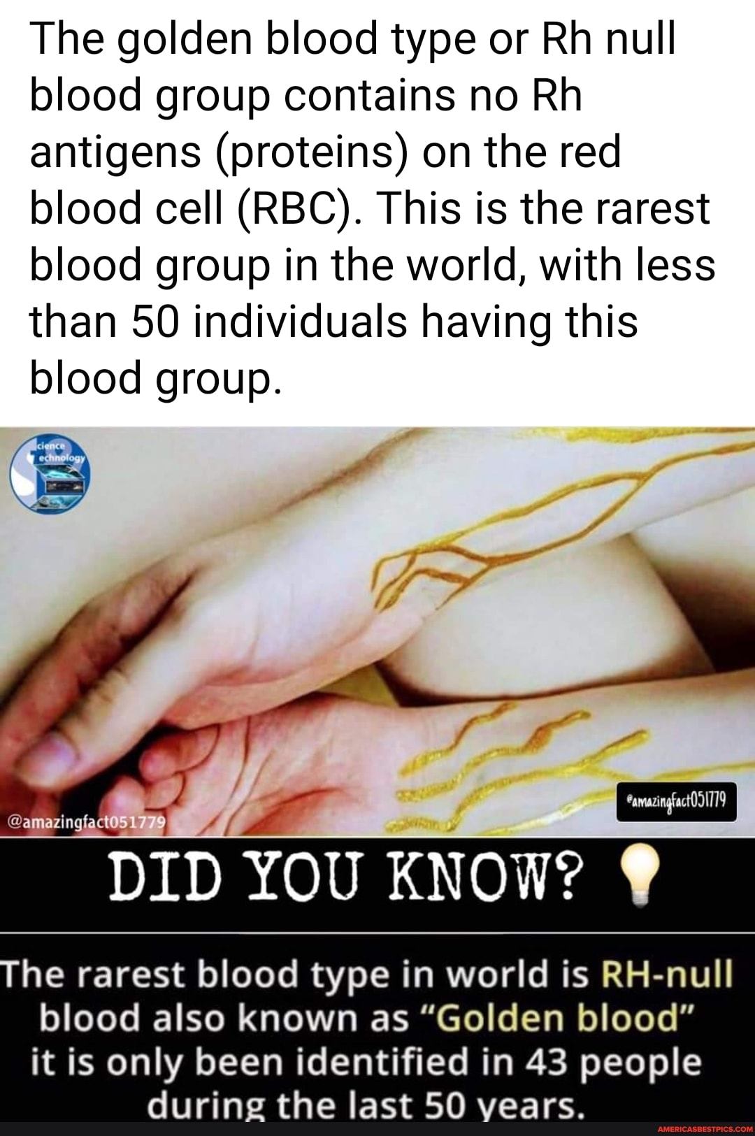 The golden blood type or Rh null blood group contains no Rh antigens (proteins) on the red blood cell (RBC). This is the rarest blood group in the world, with less than 50 individuals having this blood group.
DID YOU KNOW?
he rarest blood type in world is RH-null
blood also known as "Golden blood" it is only been identified in 43 people during the last 50 vears.