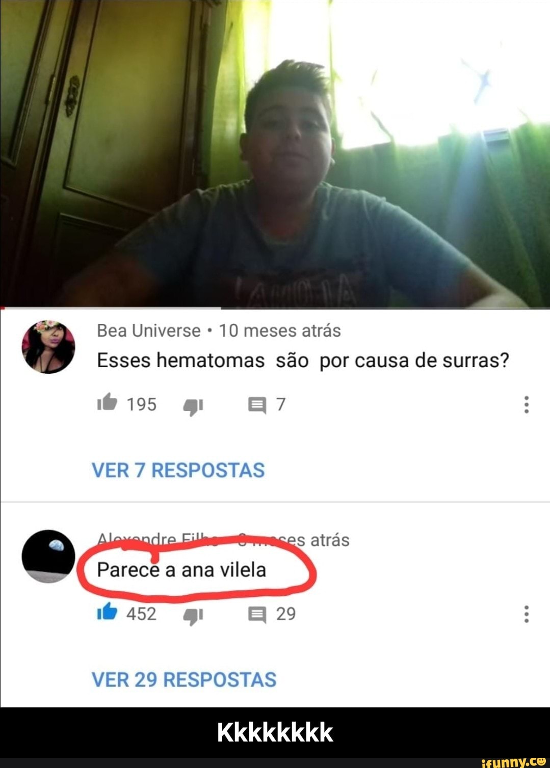 E
Bea Universe 10 meses atrás
Esses hematomas são por causa de surras?
VER 7 RESPOSTAS
VER 29 RESPOSTAS - Kkkkkkkk