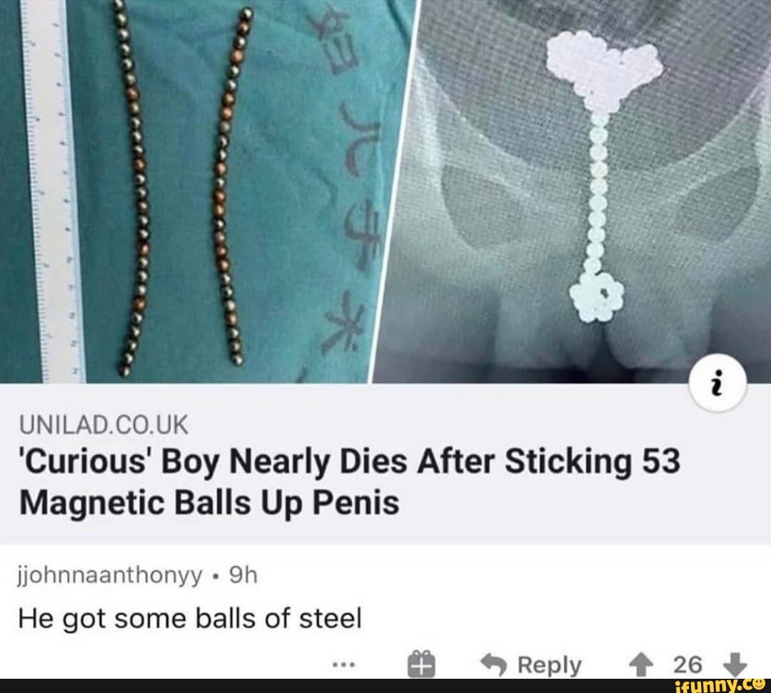 UNILAD.CO.UK
'Curious' Boy Nearly Dies After Sticking 53
Magnetic Balls Up Penis
jjohnnaanthonyy Sh
He got some balls of steel
Reply # 26