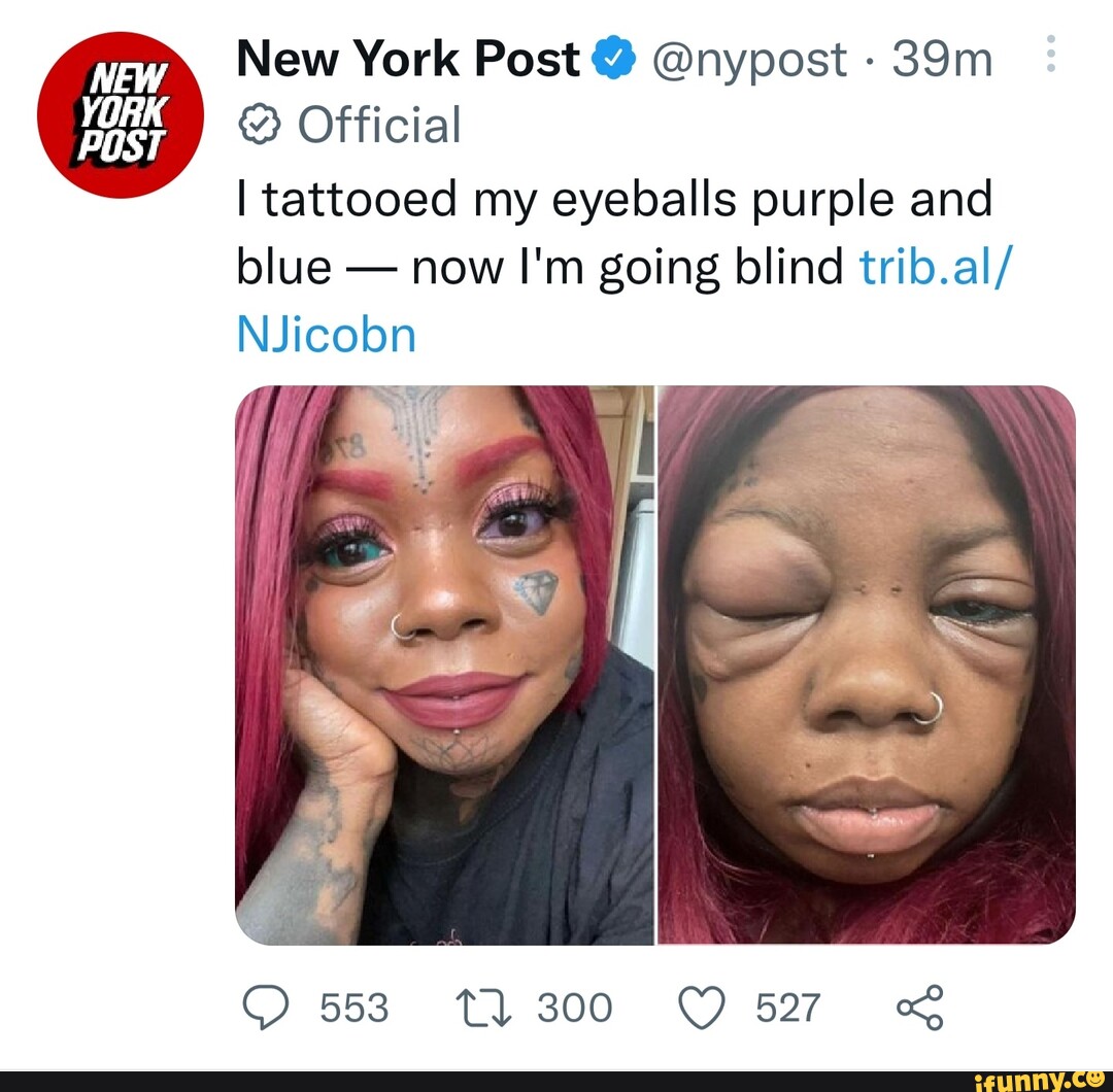 New York Post Nypost Official I Tattooed My Eyeballs Purple And   B74283fc0a5d26de78436b33774d319cc962f7f634fec2212ebe85df86f52302 1 